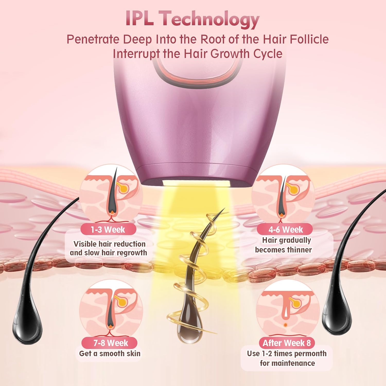 Depiladora laser IPL