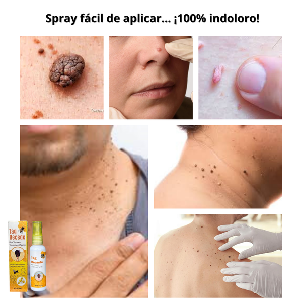 Tag Recede Eliminador Rápido